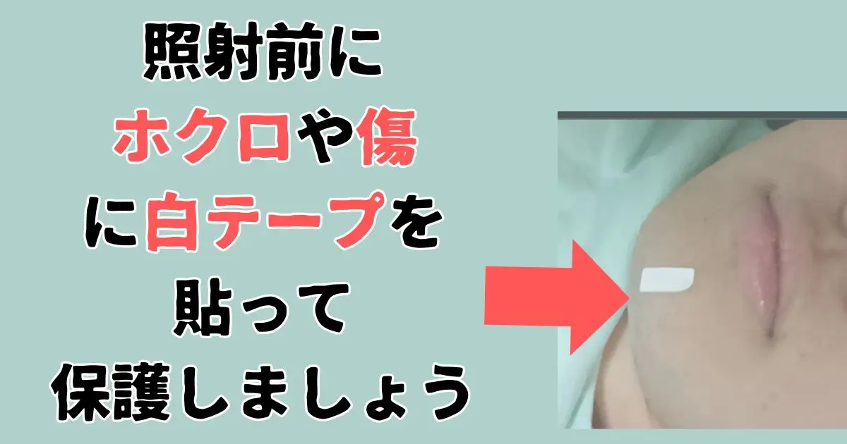 ほくろに白テープを貼って保護ている社員図解