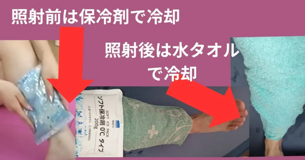 トレアパーソナルレーザー脱毛器の冷却方法は、照射前は保冷剤でキンキンに冷やす。照射後は、毛根ダメージまで回復するので、皮膚だけ冷やすように濡れたタオルで冷やすことが推奨です。
それを実行している写真付き解説図解
