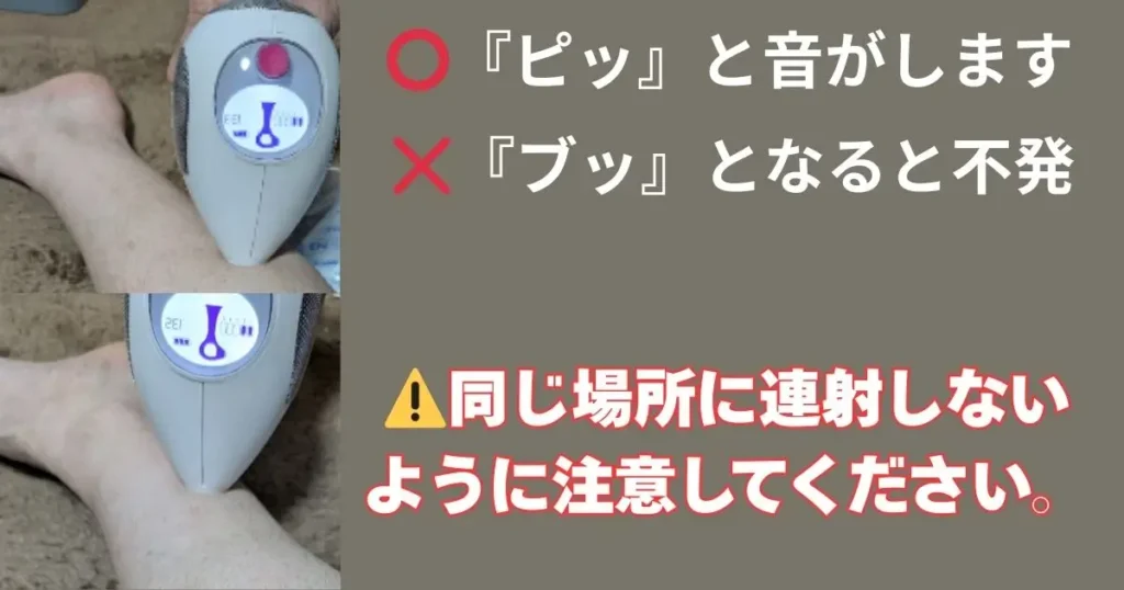 トレア脱毛器は少しずつずらす写真付き図解。ピッとなればOK・ブッとなれば不発・連射禁止の注意書き月の図解