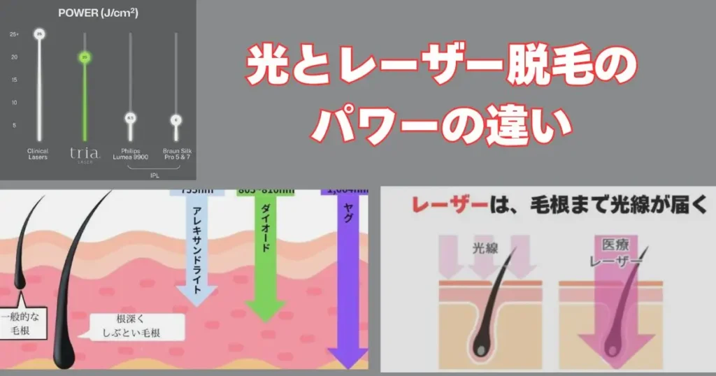 光脱毛とレーザー脱毛のパワー比較図解