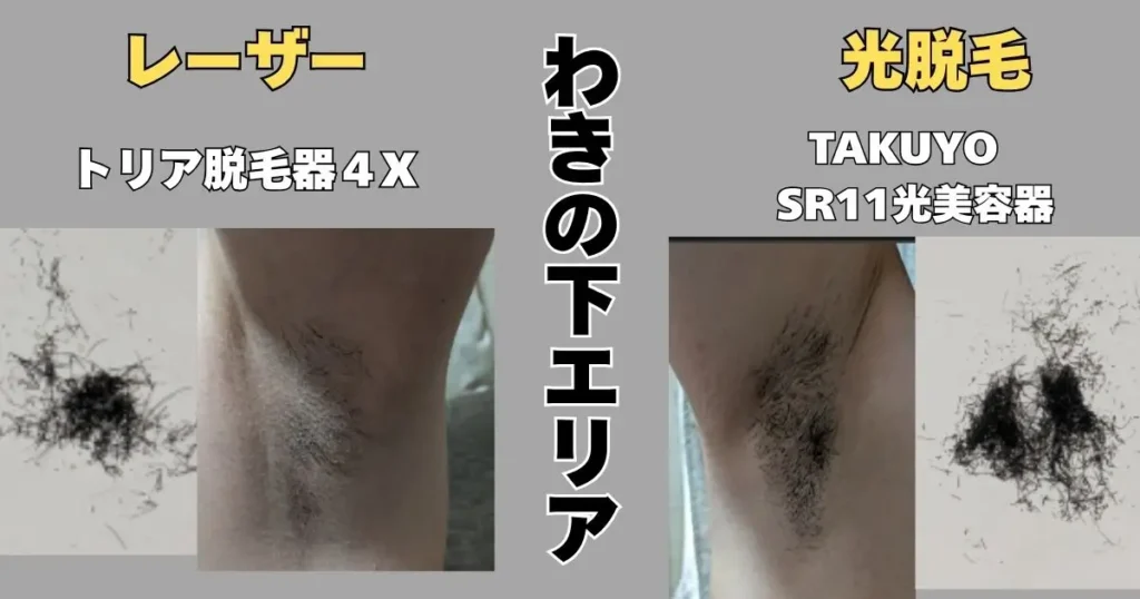 5回目わきの下エリアの経過報告