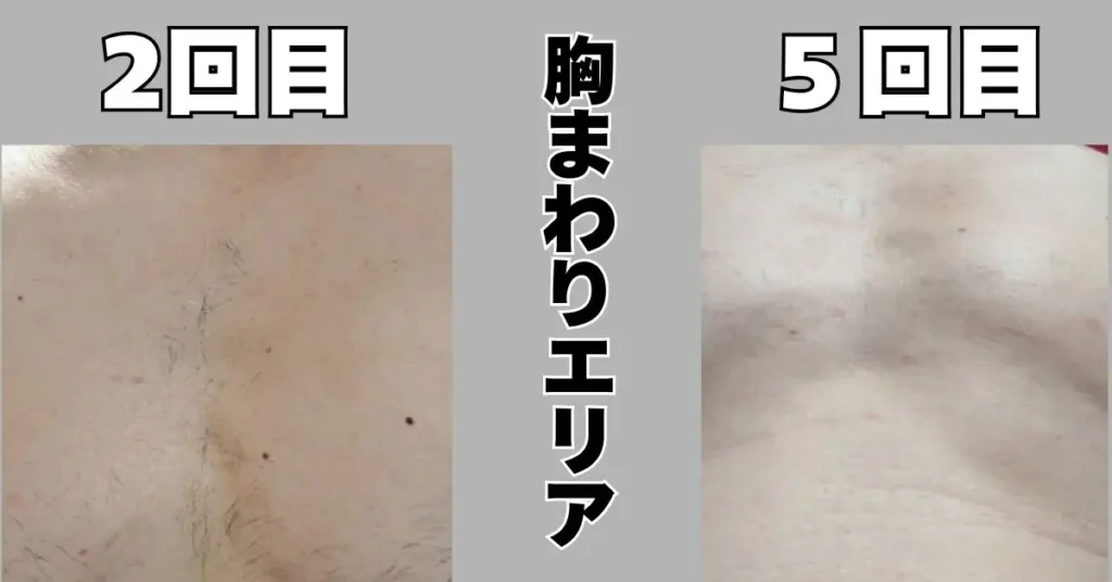 ５回目胸まわりエリア