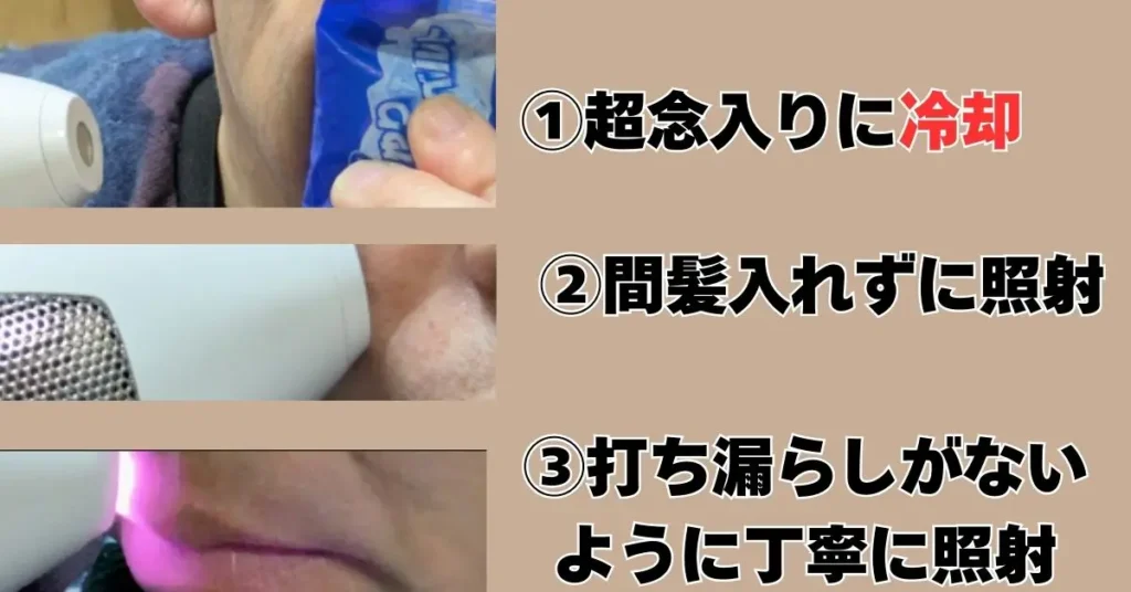 鼻下エリアの実際の照射写真で手順