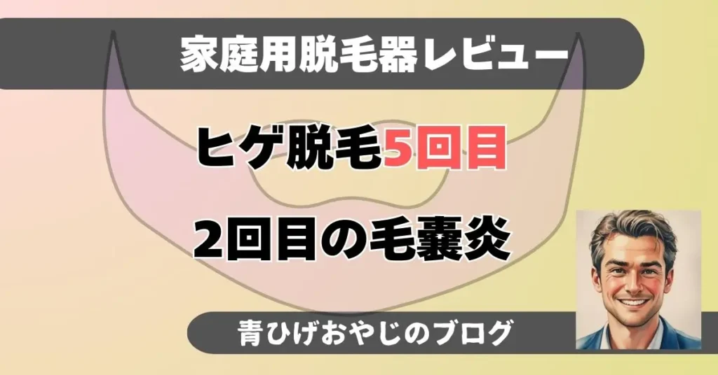 ヒゲ脱毛5回目報告記事のアイキャッチ画像