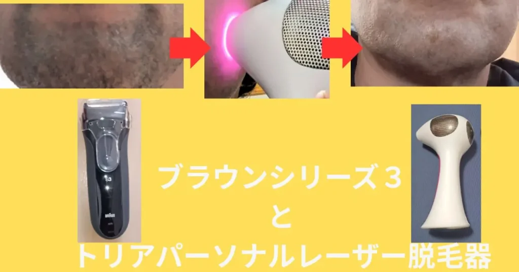 青ひげ対策ブラウンシリーズ３とトリアパーソナルレーザー脱毛器