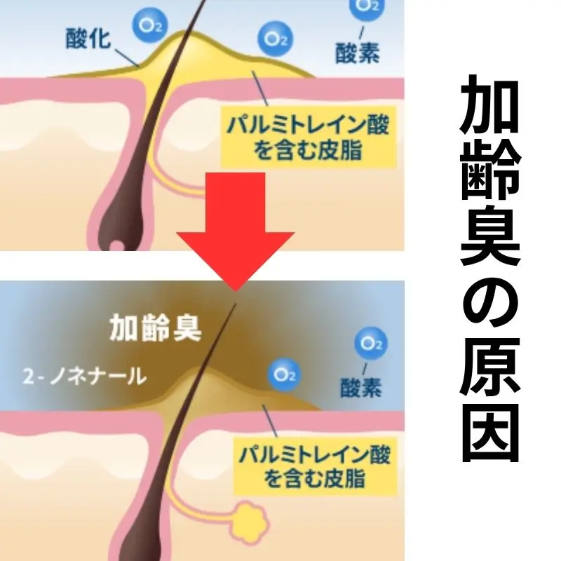 加齢臭の原因の１つ皮膚のパル未トレイン酸などの皮脂が酸化して２－ノネナールになり悪臭を放つのです