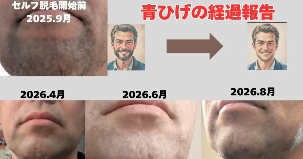 青ひげの経過報告
2025.9~2026.8